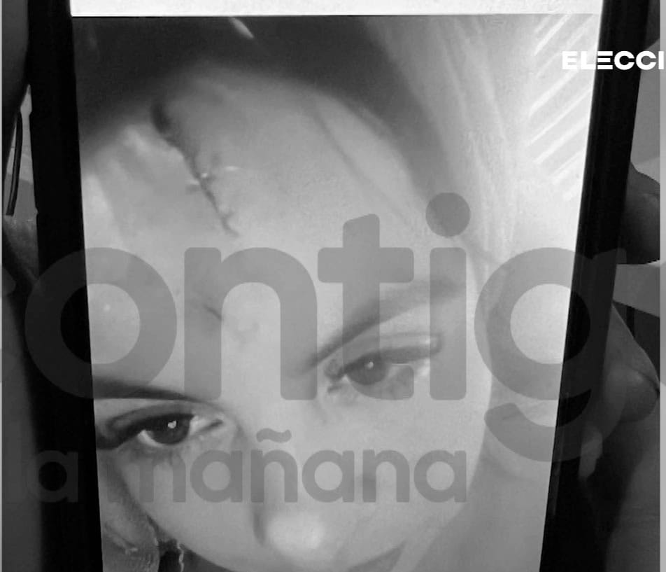 Captura pantalla Herida Cristal Aguilera